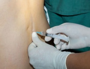 Epidural steroid injection childbirth